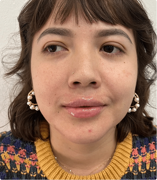 before@1.2x before@1.2x